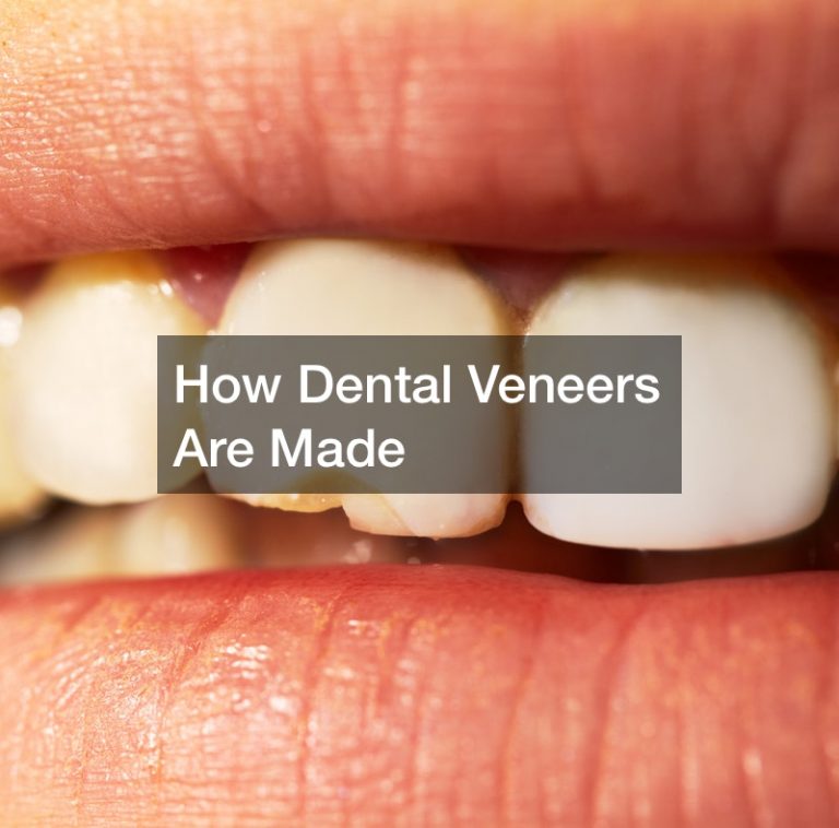 How Dental Veneers Are Made