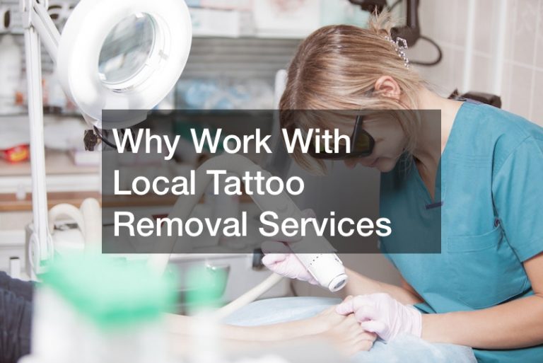 Answering Common Questions About Laser Tattoo Removal